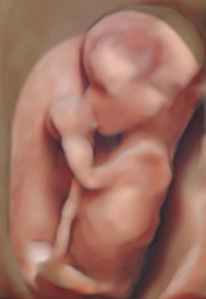 Silhouette Imaging ultrasound