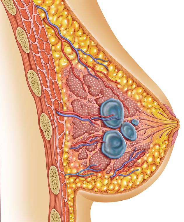 Breast Ultrasound in Temecula