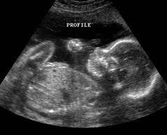 Mobile Unique Ultrasound